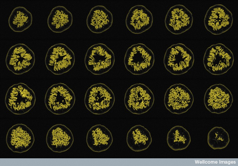Illustration for article titled This Is How Your Fruits and Vegetables Look in an MRI Machine